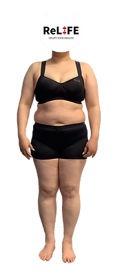 女性　ビフォー