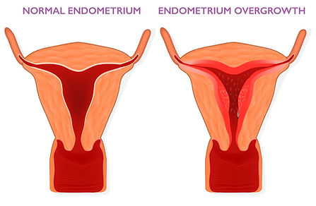 Bleedig in Surgical Menopause