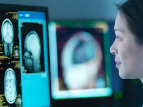 What Neuroscience Says About Binge Watching!