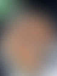 gratin de courgettes lardons thermomix