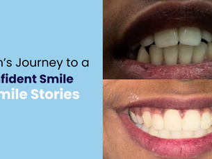Braces Treatment in Whitefield, Bangalore: A Teen’s Journey to a Confident Smile at Smile Stories