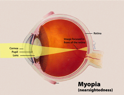  Eye care clinic LivingHope Vision Clinic in Hamilton or Burlington 
