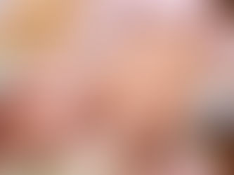 Una salchicha diaria = +11 % de riesgo de Diabetes Tipo 2