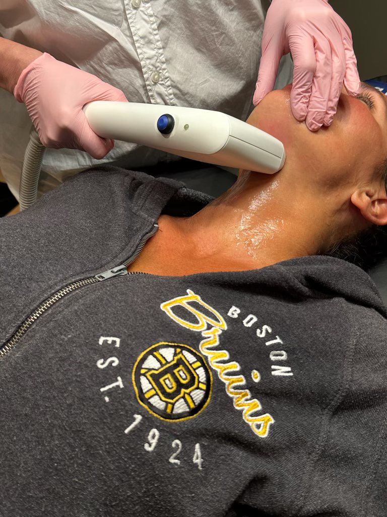 Understanding Sofwave: The Latest in Non-Surgical Skin Tightening