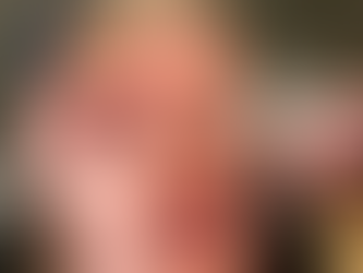 Smooth, Refine, and Relax: Neurotoxin Treatments at KYMA Anti-Aging Center