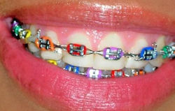 silvia arribas ortodoncia