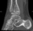 D77C7EE7-612B-4430-9425-049BDABFABB6.png