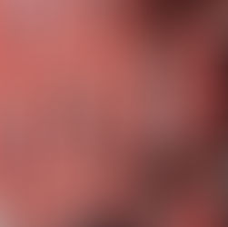 Housing’s Double Whammy for People with Disabilities