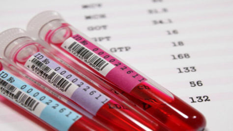 KANDA KURŞUN TESTİ