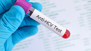ANTİ HCV TESTİ
