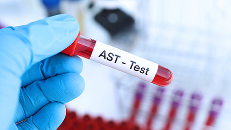 AST TESTİ