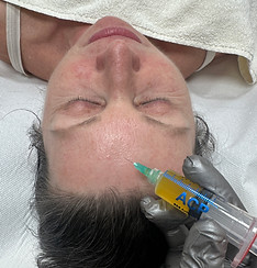 vorbereitetes Plasma