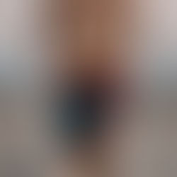 What is Hip Drop in Runners?