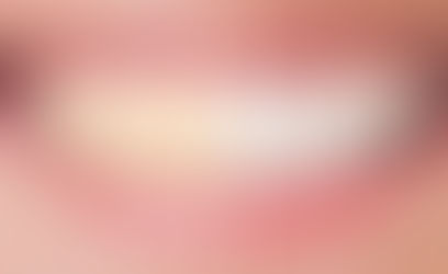 Cómo conseguir el mejor resultado de Blanqueamiento Dental