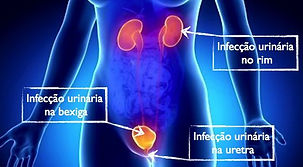 2f658d58ab63d70318fdf702bb869015-640_427