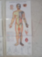 accupuncture