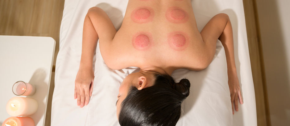 Does Cupping work?