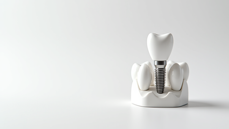 Choosing the Right Dental Implant Surgeon in North London