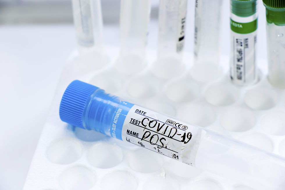 Vial labeled COVID-19 Positive