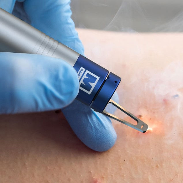 milesman_laser_milesman_blauman_tratamientos_anti_acn_eliminacin_de_lesiones_limpieza_faci