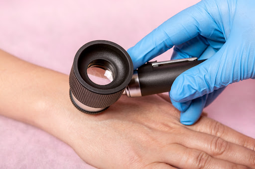 Dezembro Vermelho e a interação entre imunossupressão, HIV e oncogênese viral