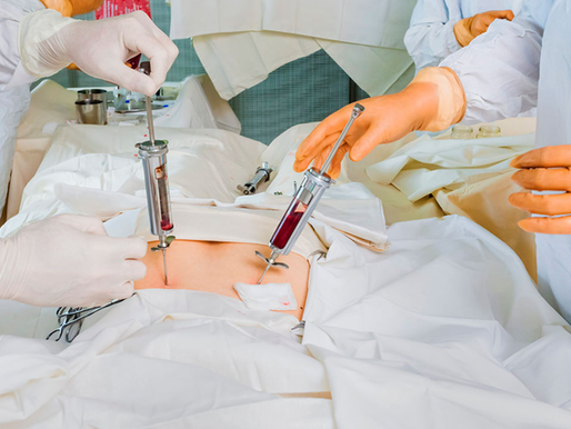O "match" perfeito: doação de medula óssea e uma nova esperança de vida