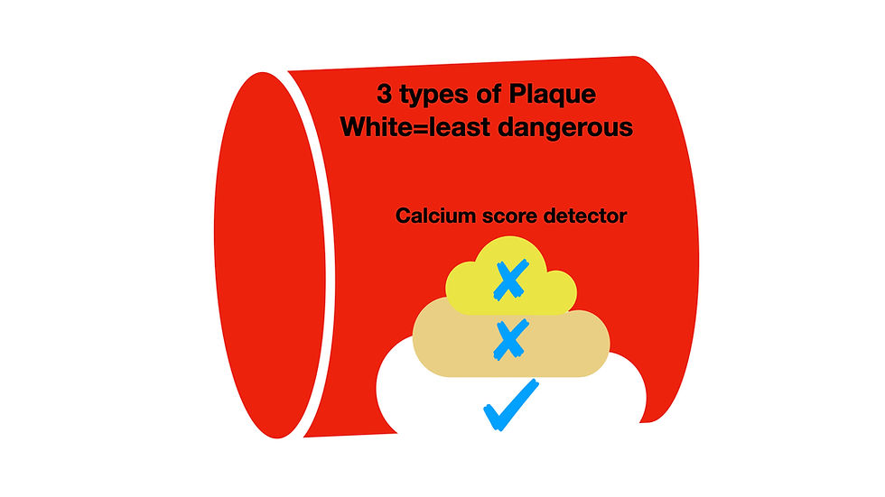 An artery with three types of plaque. Dangerous metrics (Yellow>Beige>White). Calcium score detects only white
