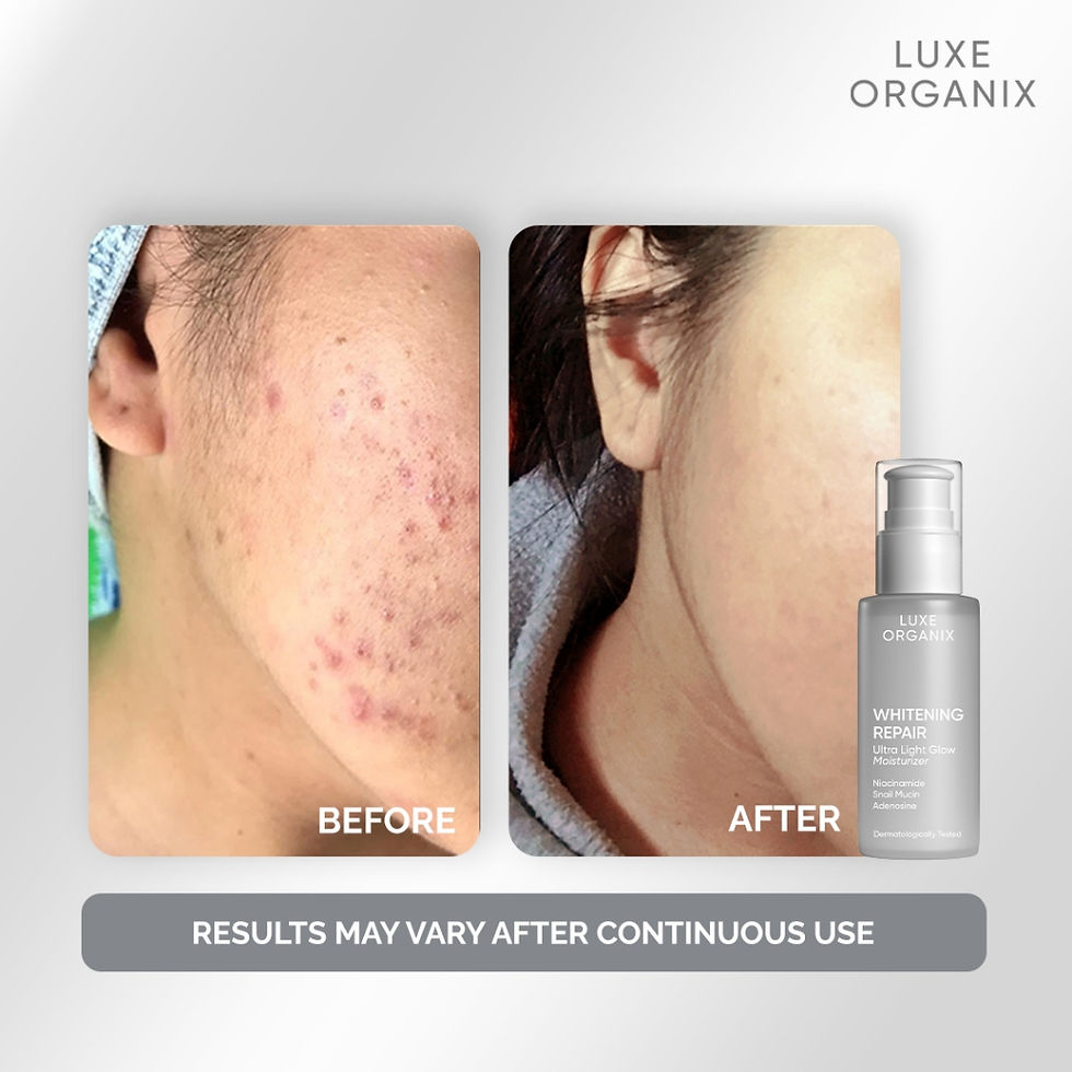 Thumbnail: Luxe Organix Whitening Repair Ultra Light Glow Moisturizer 80ml