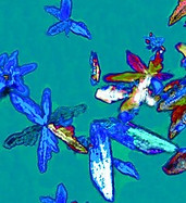 Urinary crystals and stones.