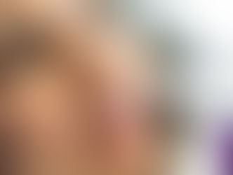 Dr Fareed Amod - Scaling and polishing for whiter teeth 