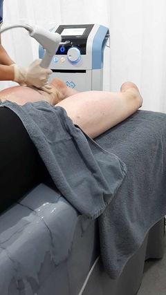 Celto treatment (Cellulite Toning) that breaks down the cellulite for a smoother appearance and better elasticity of the skin!