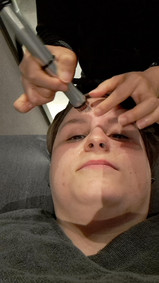 🌸 For my treatments I choose: ✅ Aqua peel is a peeling treatment for helping you remove dead skin on your face, deep clean your pores, and also help your skin hydration 🧸Excel V Laser that reduces redness, freckles and is effective in improving wrinkles 👉Modeling mask