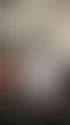 🌸 For my treatments I choose: ✅ Aqua peel is a peeling treatment for helping you remove dead skin on your face, deep clean your pores, and also help your skin hydration 🧸Excel V Laser that reduces redness, freckles and is effective in improving wrinkles 👉Modeling mask