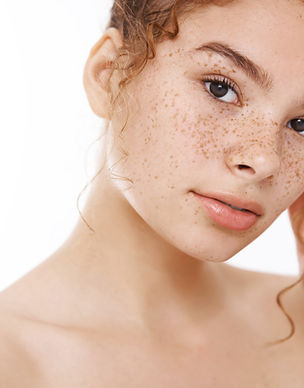 a young woman with lots of freckles looking at the camera