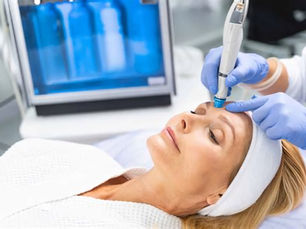 Hydrapeel - Hydro dermabrasie