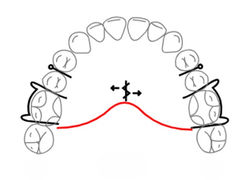 Maxillary Schwarz