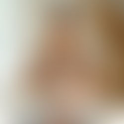 Peptides & Immune Support: How to Strengthen Your Body Naturally