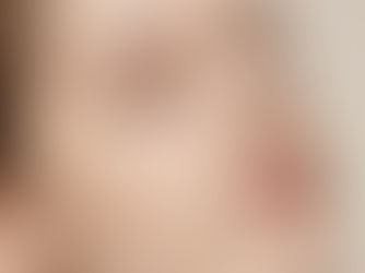 Advanced Skin Treatment Services in Sheffield for Acne, Aging & More