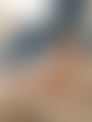 Day 3 vs. Day 5 Embryo Transfer: Why Blastocyst Transfer Matter