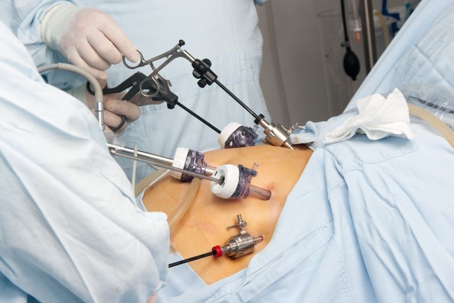 Laparoscopic Surgery Procedure