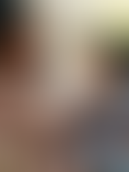 Hysteroscopy and Laparoscopy for Infertility: How Surgery Improves IVF Success