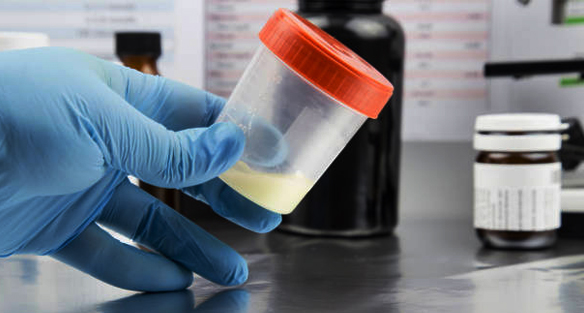 Scientist analyzing sperm preparation in the laboratory