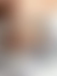 Diagnosed with Unexplained Infertility? Your Best Options in 2026