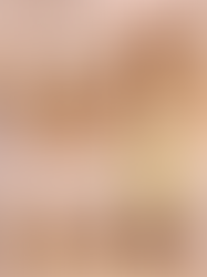 Why Karseell Collagen Hair Mask Is the Best Choice for Deep Hair Repair and Daily Hair Care