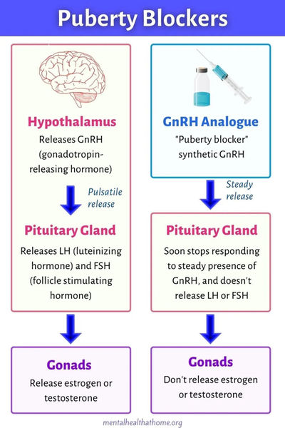 puberty-blockers.jpeg