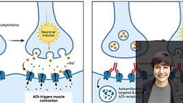 A Current Review of Myasthenia Gravis (MG): Speech & Swallowing Mechanisms