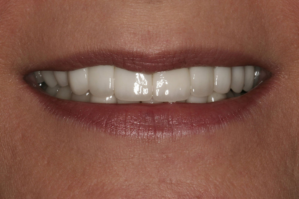 Patient 8 After