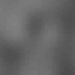 Mani contro la montagna dopo lavoro di riabilitazione mano