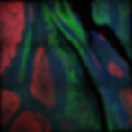 human tonsils, FFPE section, 3-plex with commercially available antibodies