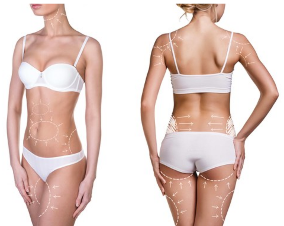 Thumbnail: Lipo Lax + Slimming Solution